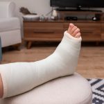 Caviglia rotta smart working canva