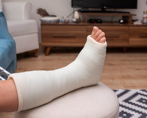 Caviglia rotta smart working canva