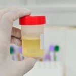 Urina fertilizzante canva